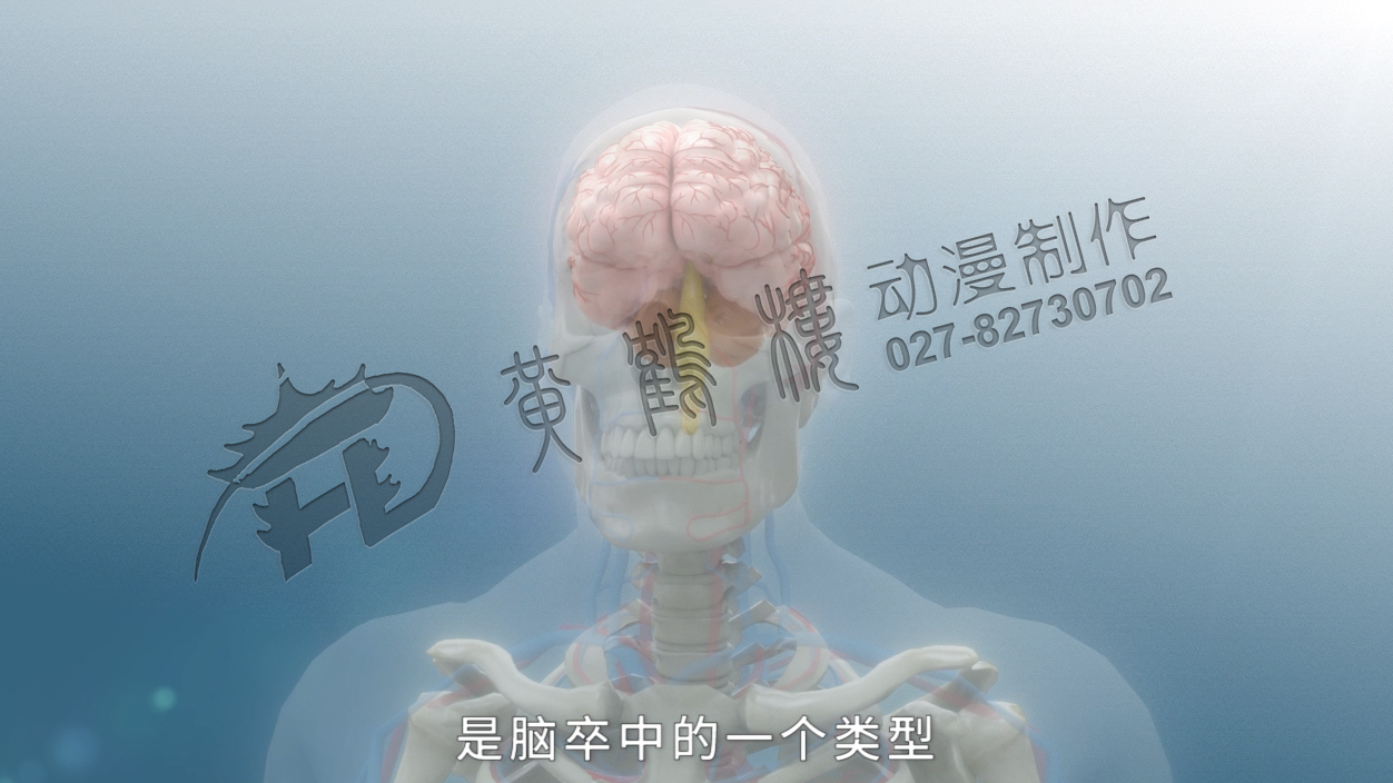 《缺血性脑卒中》三维医疗科普动画宣传片.jpg
